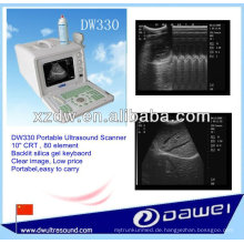 2d tragbarer volldigitaler Ultraschallscanner